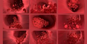 Bilde av innsiden av arteriene i en menneskekropp sett gjennom et mikroskop